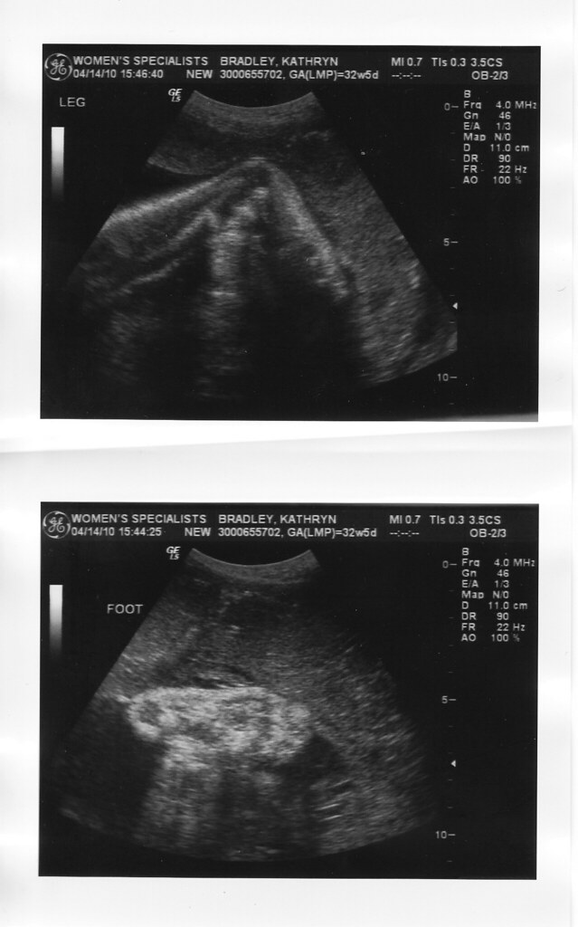 ultrasounds 32 weeks_0002