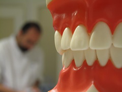 虫歯治療と歯周病治療