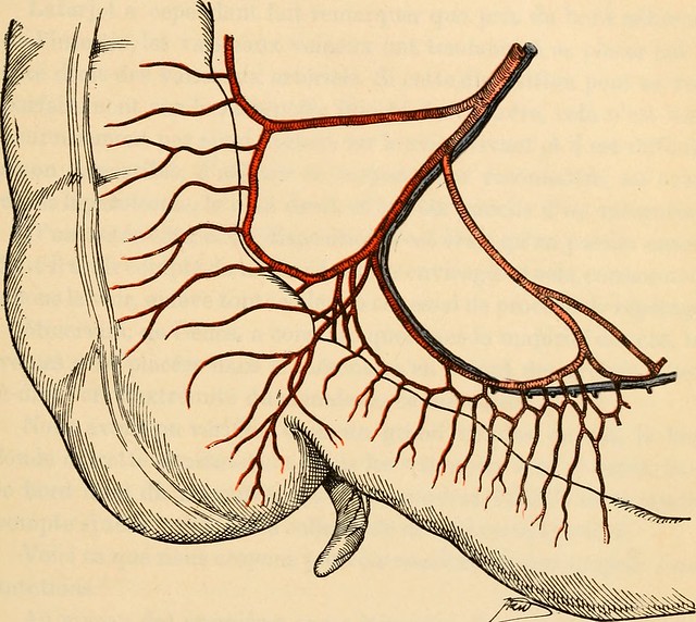 Image from page 200 of Anatomie médico-chirurgicale de labdomen (1922)