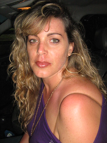 Toda queimada do sol !!!