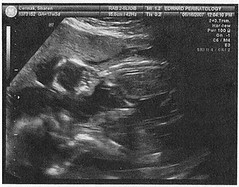 gav.evie.ultrasound.5.16.2007