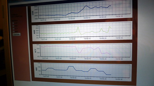 My real-time vitals