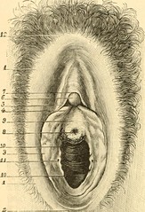 Anglų lietuvių žodynas. Žodis vestibule of the vagina reiškia prieškambaris, iš makšties lietuviškai.