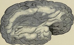 Anglų lietuvių žodynas. Žodis superficial middle cerebral vein reiškia paviršutiniškas vidurinės smegenų venų lietuviškai.